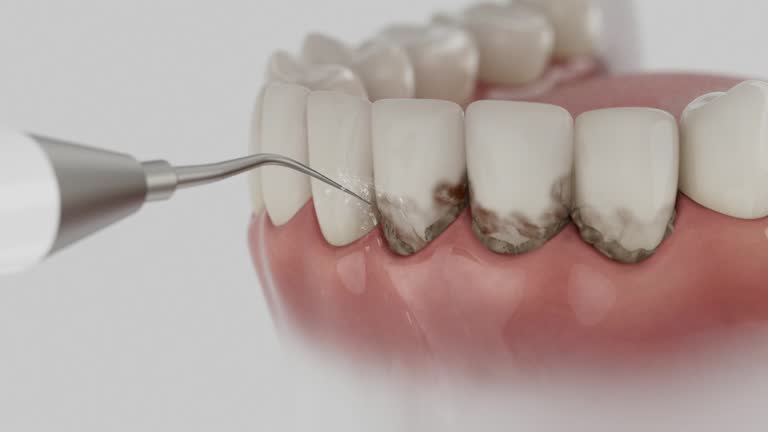 Trusted Teeth Cleaning And Checkup service in Forks, WA - Dentist Open Now